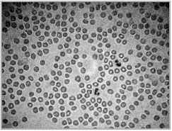 Рис. 100. Красные кровяные тельца (эритроциты) под микроскопом